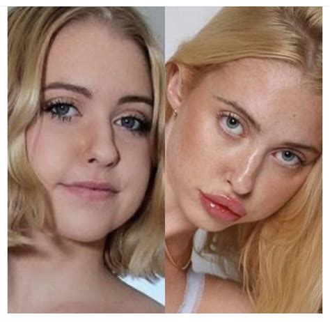 chloe cherry before after|what happened to chloe cherry.